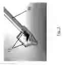 Fig. 06 - Substantially rigid and stable endoluminal surgical suite for treating a gastrointestinal lesion