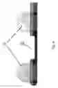 Fig. 07 - Substantially rigid and stable endoluminal surgical suite for treating a gastrointestinal lesion