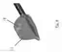 Fig. 09 - Substantially rigid and stable endoluminal surgical suite for treating a gastrointestinal lesion