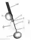 Fig. 10 - Substantially rigid and stable endoluminal surgical suite for treating a gastrointestinal lesion