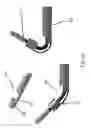Fig. 15 - Substantially rigid and stable endoluminal surgical suite for treating a gastrointestinal lesion