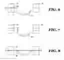Fig. 06 - SUTURE GUIDE AND RUPTURED TISSUE REPAIR