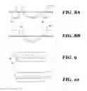 Fig. 07 - SUTURE GUIDE AND RUPTURED TISSUE REPAIR