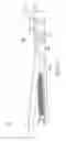 Fig. 113 - Powered surgical instrument with parameter-based firing rate