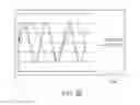 Fig. 72 - Powered surgical instrument with parameter-based firing rate