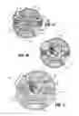 Fig. 12 - Adapter assembly including a removable trocar assembly