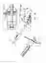 Fig. 03 - LEFT ATRIAL APPENDAGE CLOSURE