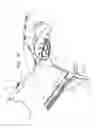Fig. 05 - LEFT ATRIAL APPENDAGE CLOSURE