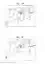 Fig. 10 - LEFT ATRIAL APPENDAGE CLOSURE