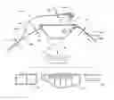 Fig. 01 - Point specific junctional tourniquet