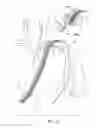 Fig. 05 - Point specific junctional tourniquet