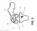 Fig. 06 - Devices and methods for knee arthroplasty