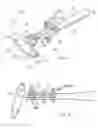 Fig. 04 - Soft tissue reconstruction