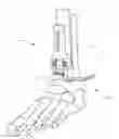 Fig. 01 - METHODS AND INSTRUMENTS FOR SUBCHONDRAL TREATMENT OF OSTEOARTHRITIS IN A SMALL JOINT