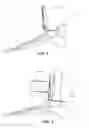 Fig. 04 - METHODS AND INSTRUMENTS FOR SUBCHONDRAL TREATMENT OF OSTEOARTHRITIS IN A SMALL JOINT
