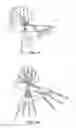 Fig. 06 - METHODS AND INSTRUMENTS FOR SUBCHONDRAL TREATMENT OF OSTEOARTHRITIS IN A SMALL JOINT