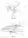 Fig. 18 - METHODS AND INSTRUMENTS FOR SUBCHONDRAL TREATMENT OF OSTEOARTHRITIS IN A SMALL JOINT