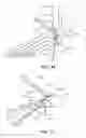 Fig. 20 - METHODS AND INSTRUMENTS FOR SUBCHONDRAL TREATMENT OF OSTEOARTHRITIS IN A SMALL JOINT