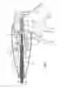 Fig. 06 - Forceps with a rotation assembly