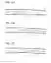 Fig. 19 - Tissue-removing catheter with ball and socket deployment mechanism