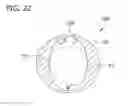 Fig. 24 - Tissue-removing catheter with ball and socket deployment mechanism