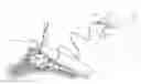 Fig. 01 - Devices and methods for guiding a surgical instrument