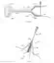 Fig. 04 - Devices and methods for guiding a surgical instrument