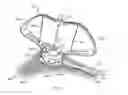 Fig. 09 - Devices and methods for guiding a surgical instrument