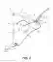 Fig. 04 - Surgical guidance devices, systems, and methods