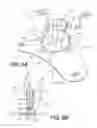Fig. 06 - Surgical guidance devices, systems, and methods