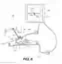 Fig. 07 - Surgical guidance devices, systems, and methods