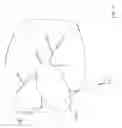Fig. 04 - Fornix manipulator