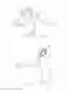 Fig. 13 - Spinal stabilization system and method
