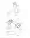 Fig. 14 - Spinal stabilization system and method