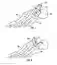 Fig. 06 - Bone implant and means of insertion