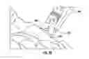 Fig. 19 - Bone implant and means of insertion