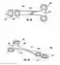 Fig. 24 - Bone implant and means of insertion