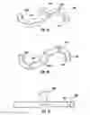 Fig. 29 - Bone implant and means of insertion