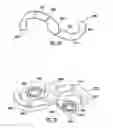 Fig. 30 - Bone implant and means of insertion