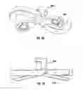 Fig. 33 - Bone implant and means of insertion
