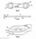 Fig. 35 - Bone implant and means of insertion