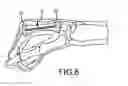 Fig. 07 - Bone stabilization device