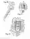 Fig. 06 - POLYAXIAL BONE ANCHOR WITH HELICAL CAPTURE CONNECTION, INSERT AND DUAL LOCKING ASSEMBLY