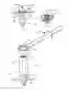 Fig. 06 - Universal implant-to-bone fixation system