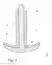 Fig. 02 - METHOD FOR PRODUCING A FLAT ELECTRODE