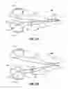 Fig. 05 - Surgical forceps