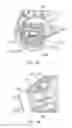 Fig. 19 - Electrosurgical device
