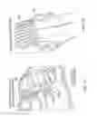 Fig. 32 - Electrosurgical device