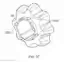 Fig. 35 - Electrosurgical device