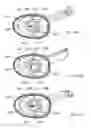 Fig. 34 - Electrosurgical device